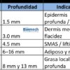 HIFU22D PROFUNDIDADES